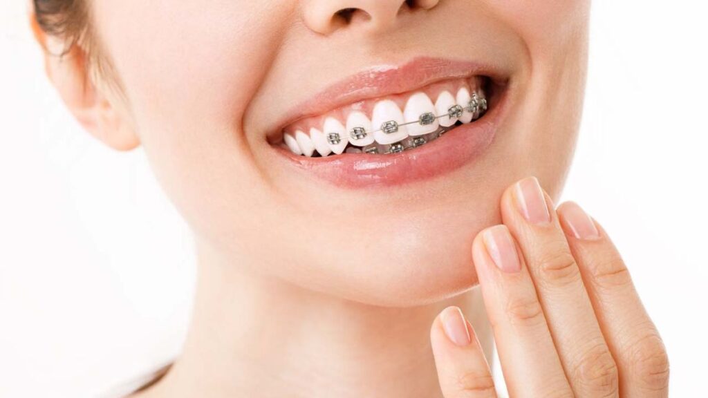 Orthodontic