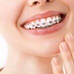 Signs It’s Time To Consider Orthodontic Treatment: What To Watch For